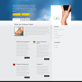 The Best Varicose Veins Treatment: varicose veins treatment